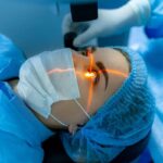 Cataract Surgery Cost in Australia: Price Breakdown & Financial Options